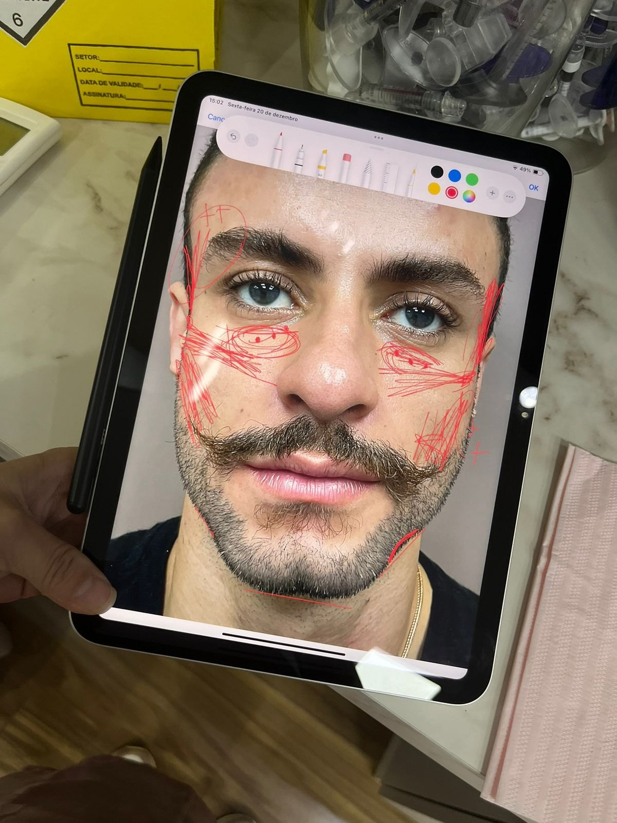 Marcação digital de um planejamento facial masculino